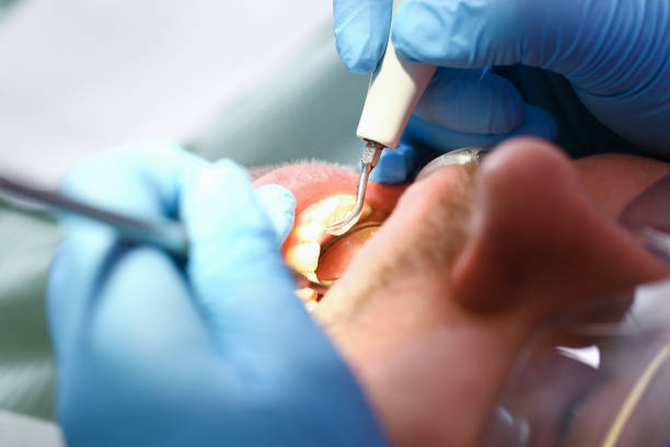 Best Urgent Tooth Repair  in Salem, IN