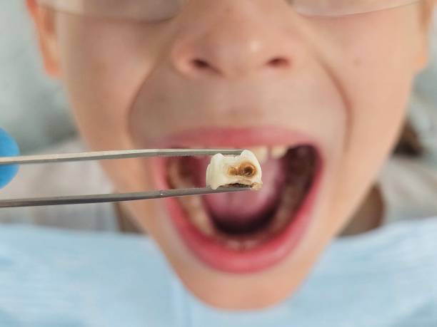 Emergency Dentist for Kids in IN